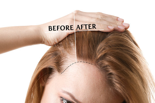 Secconil HG Shampoo: Pakistan’s Dermatologist-Backed Hair Growth Solution