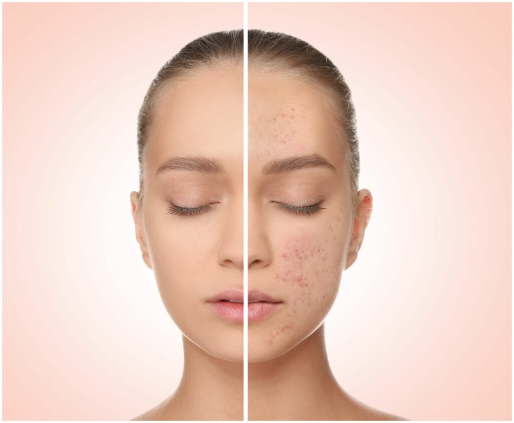 Curaderm Bar by Wisdom Pharma: Dermatologist-Recommended Skincare for Acne, Eczema & Fungal Infections in Pakistan